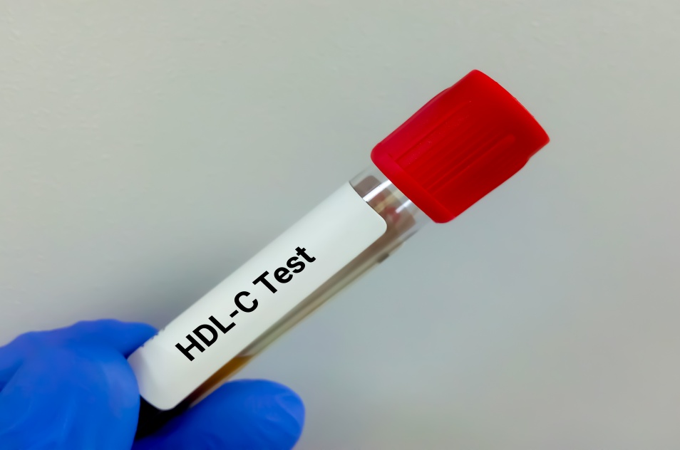 HDL 콜레스테롤-HDL 콜레스테롤 수치-HDL 콜레스테롤 운동-HDL 콜레스테롤 낮은 이유-파이토웨이-썸네일