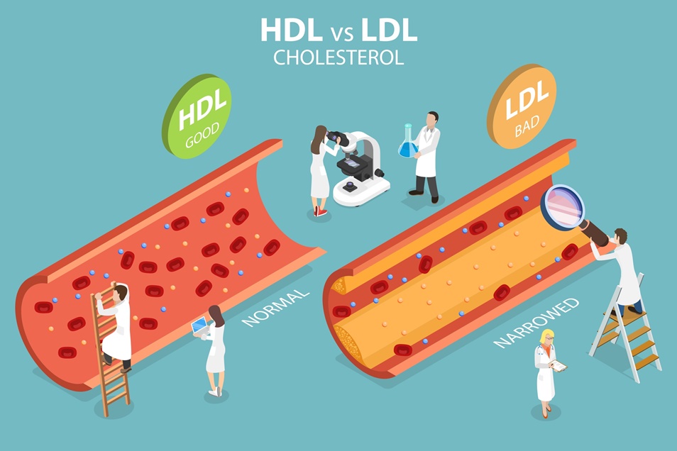 고지혈증-좋은콜레스테롤-HDL4