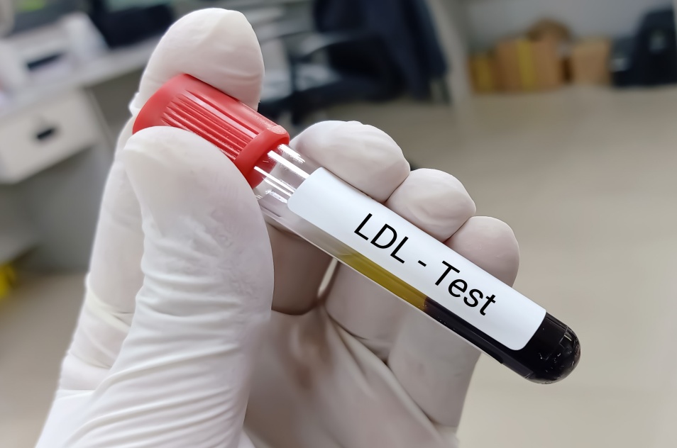LDL-LDL콜레스테롤-콜레스테롤-파이토웨이-1